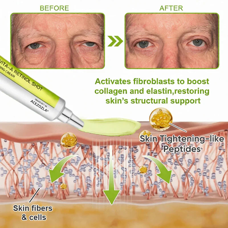 ✨Final 3 Hours: 70%OFF🔥Acezozla™ Botulinum & Vita-A Retinol Shot Wrinkle-Lift Tightening cream✨